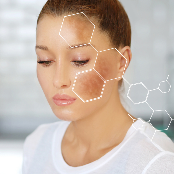 Tips for Protecting Your Skin from Sun Damage