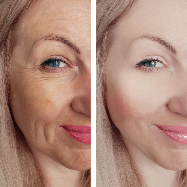 Top Skin Problems and How to Solve Them Visible Results Pawleys Island South Carolina