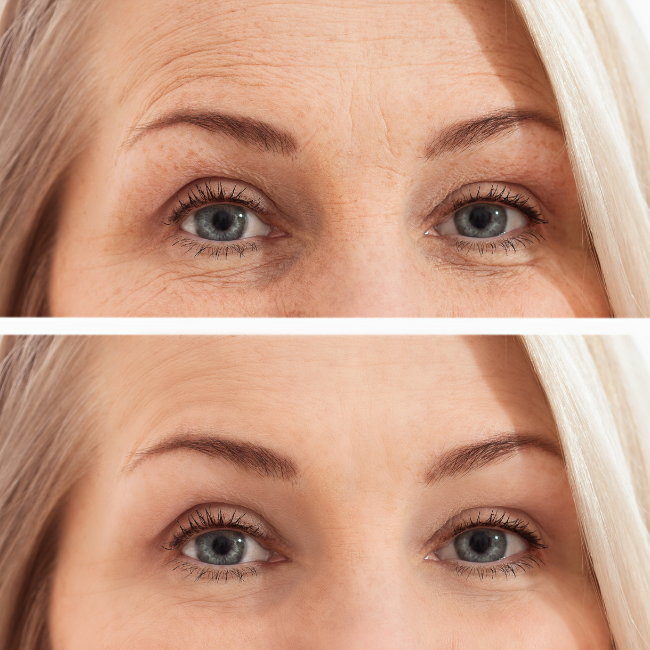 Visible Results Make 2024 Your Most Youthful Looking Year Yet with Anti-Aging Spa Treatments! Pawleys Island South Carolina (1)