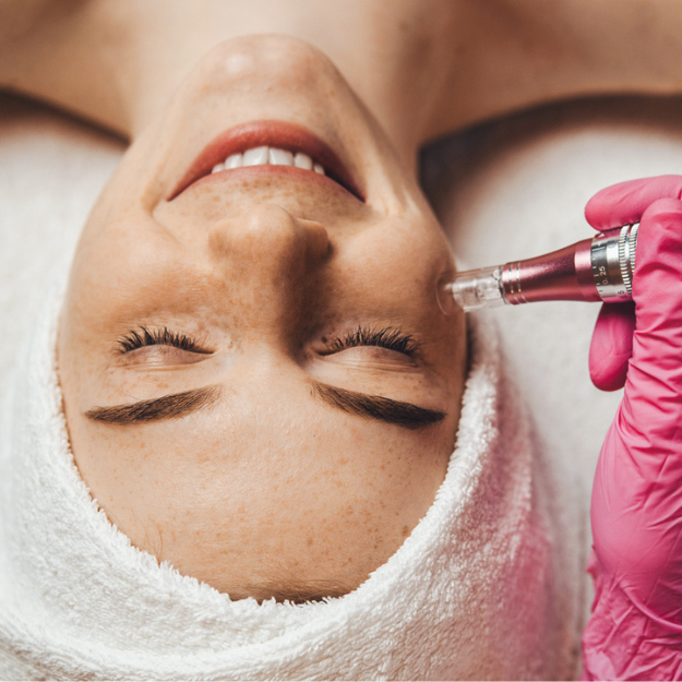 MicroPeels Your Comprehensive Guide to What to Expect, Visible Results Pawleys Island SC
